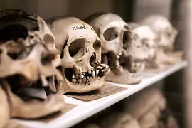 Collection of Anatomical Pathology in the Madhouse Tower